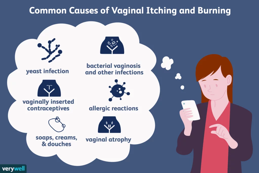 Common Causes of vaginal itching