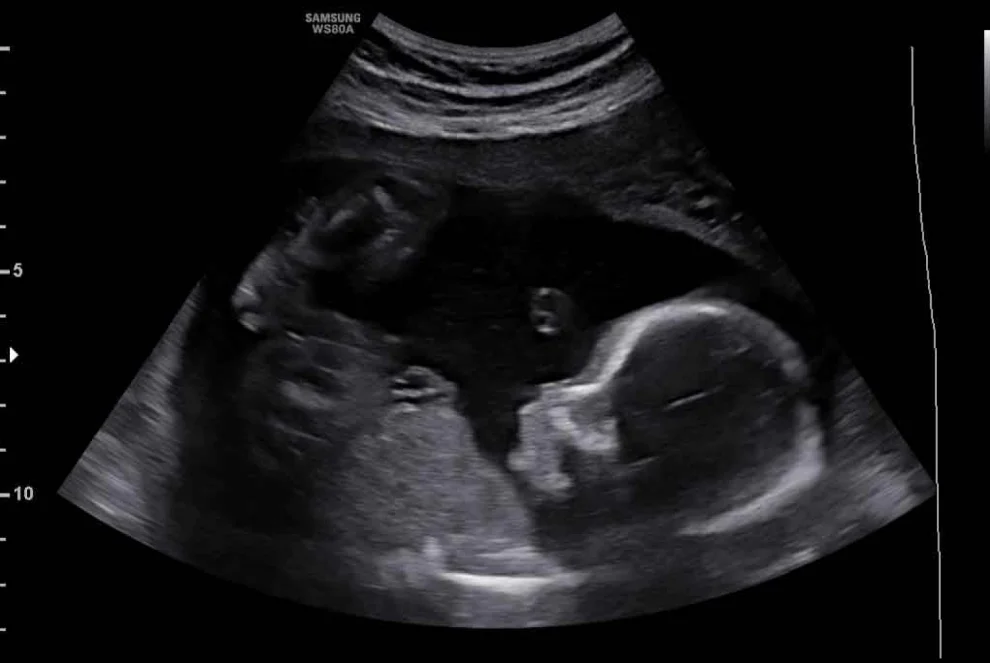 Gender Scan