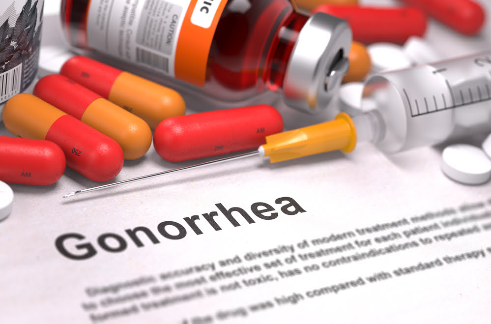 Treatment Options for Gonorrhea