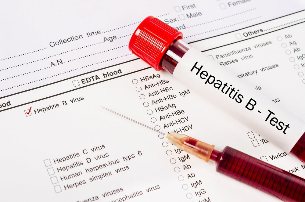 Hepatitis B blood test