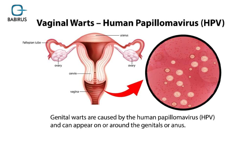 Human Papillomavirus (HPV): Symptoms, Treatment & Prevention in Malaysia 13 Human Papillomavirus