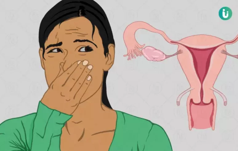 Vaginal Odor: Everything You Need to Know in Malaysia 2 Normal Vaginal Odor