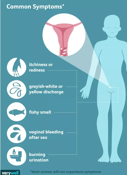 Vaginal Odor: Everything You Need to Know in Malaysia 4 Vaginal Odor Infections and Symptoms