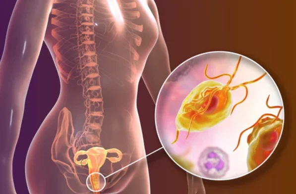Vaginal Odor: Everything You Need to Know in Malaysia 1 Vaginal Odor