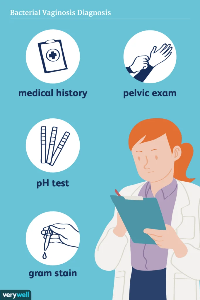 bacterial vaginosis diagnosis