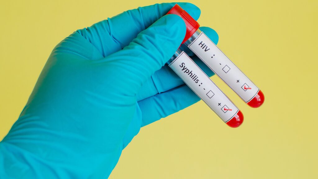 HPV Test for prevent sexually transmitted diseases