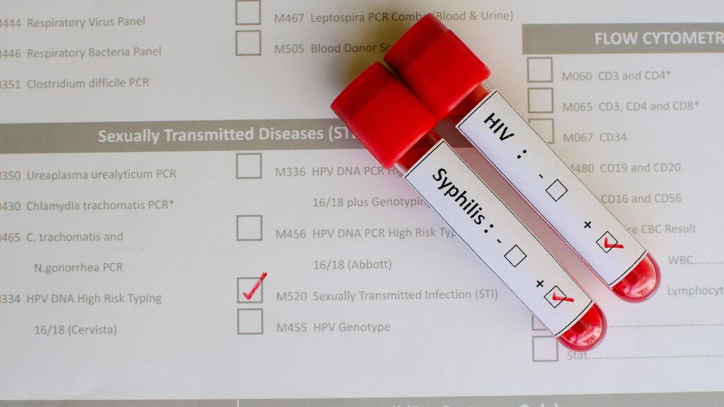 pcr blood test for testing sexually transmitted diseases