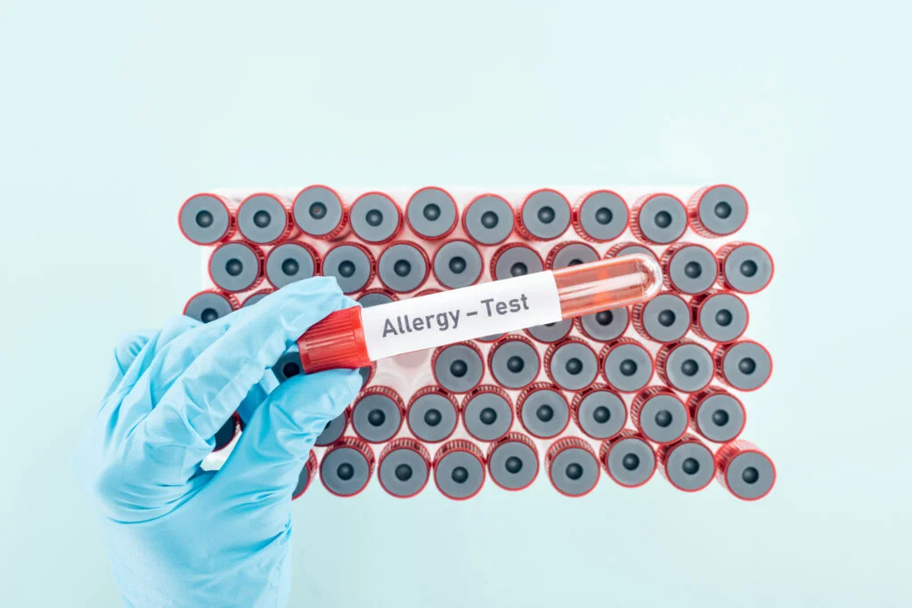 Allergy blood test