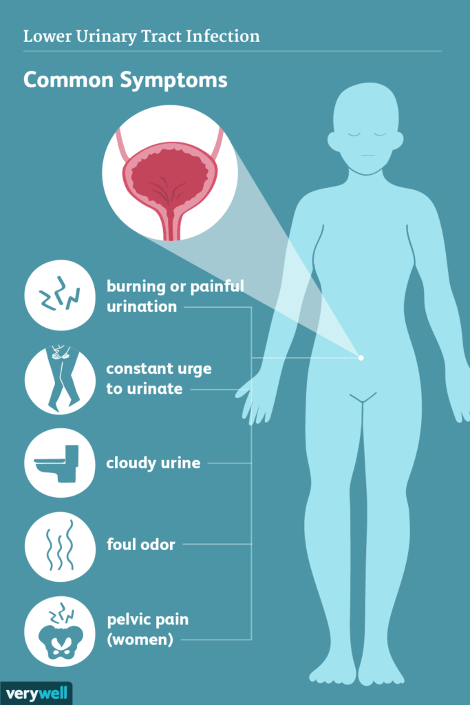 Common Symptoms of UTIs