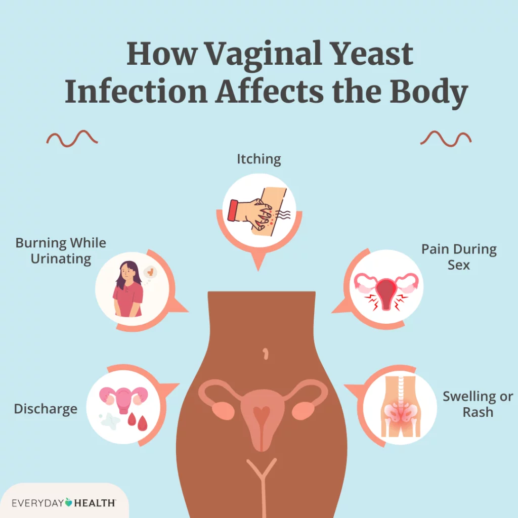 Vaginal Yeast Infection: Everything You Need to Know in Malaysia 3 Common Symptoms of vaginal yeast infection