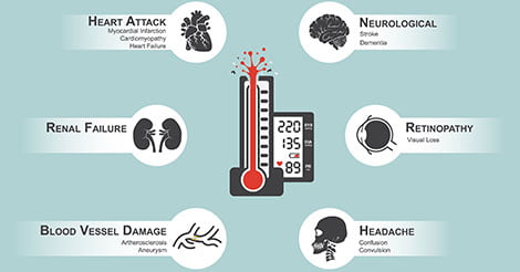 Complications of Hypertension