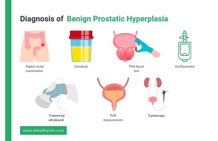 Diagnosing BPH