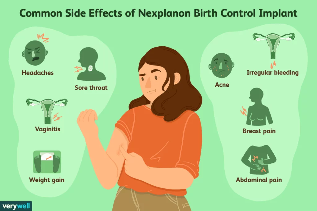 Implanon: Everything You Need to Know in Malaysia 7 Potential Side Effects of Implanon