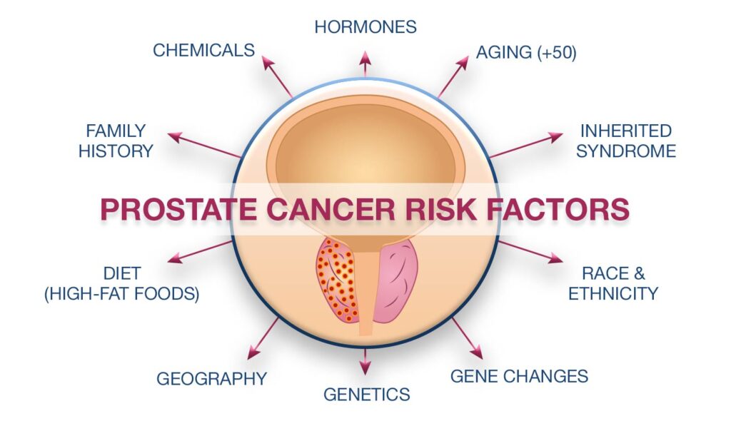 Prostate Cancer Risk Factors