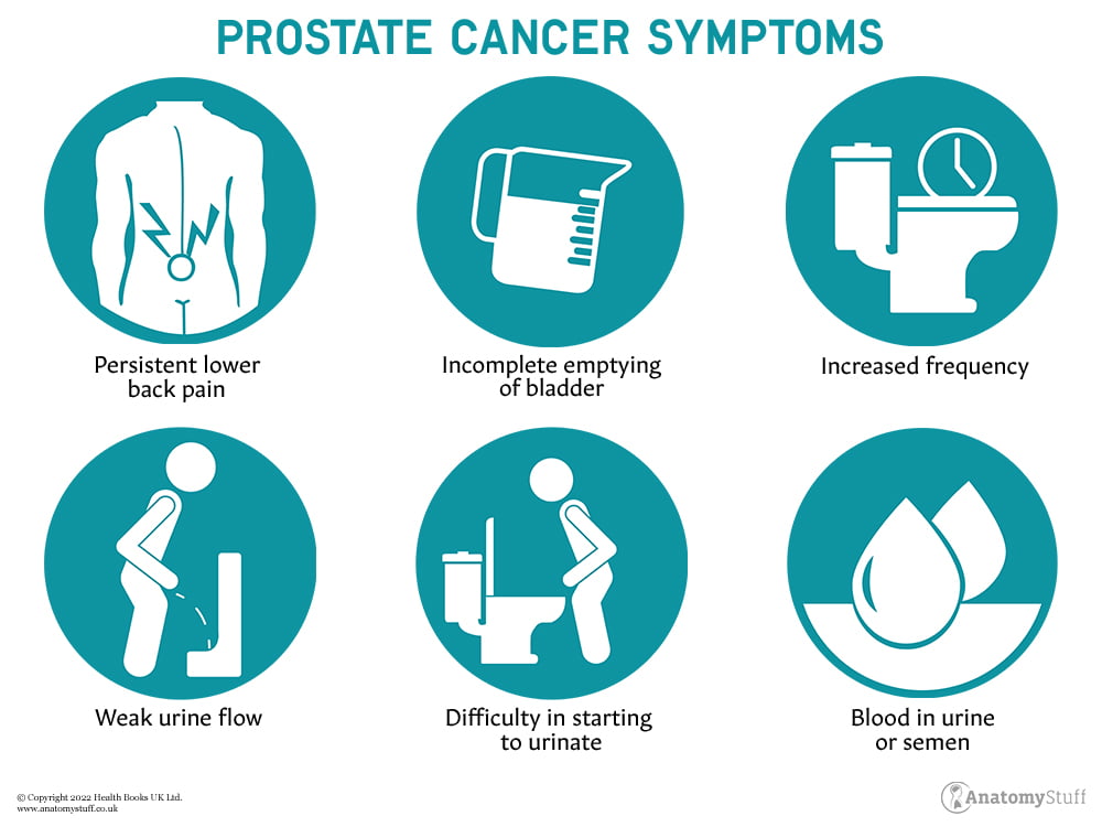 Prostate Cancer Symptoms