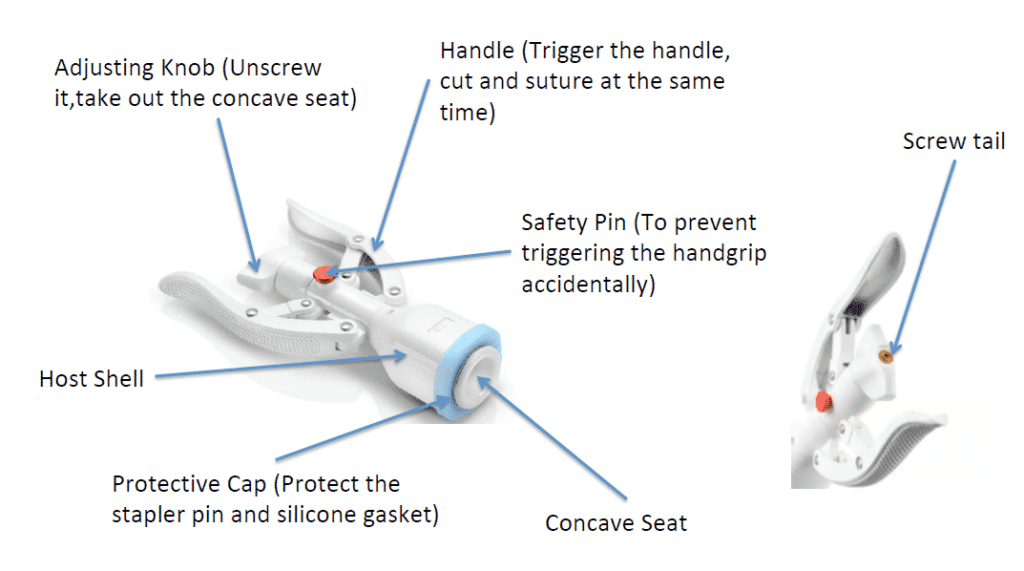 Stapler Circumcision