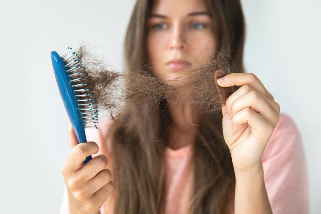 Stress and Hair Loss