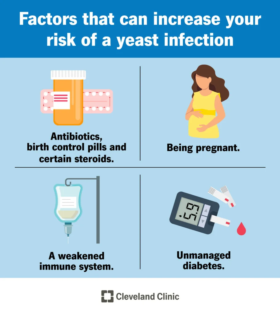 Vaginal Yeast Infection: Everything You Need to Know in Malaysia 4 Vaginal Yeast Infection Causes and Triggers