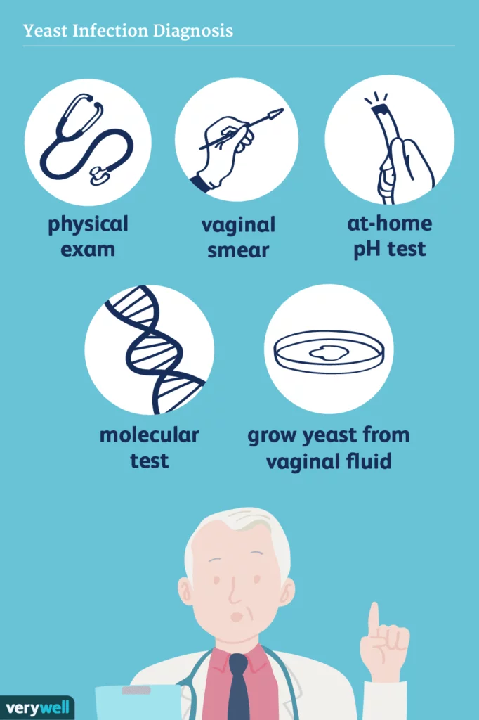 Vaginal Yeast Infection: Everything You Need to Know in Malaysia 5 Vaginal Yeast Infection Diagnosis