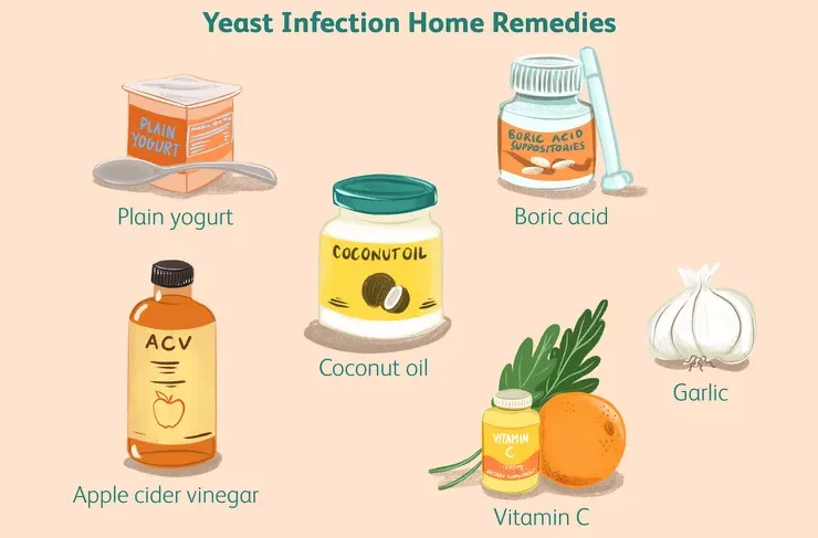 Vaginal Yeast Infection: Everything You Need to Know in Malaysia 6 Vaginal Yeast Infection Home Remedies