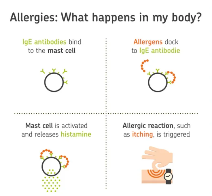 what is allergy