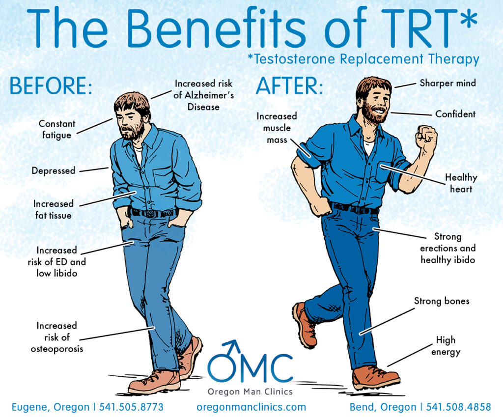 Testosterone Replacement Therapy (TRT): Everything You Need to Know in ...