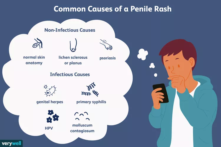 causes of penile rash malaysia