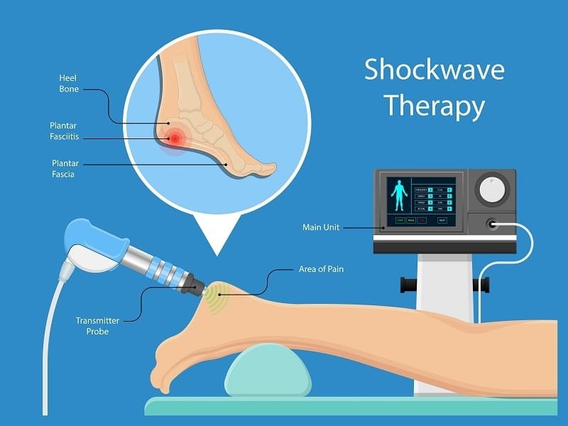 shockwave therapy malaysia