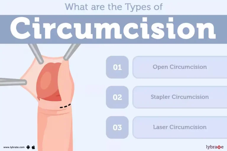 types of circumcision adult circumcision malaysia