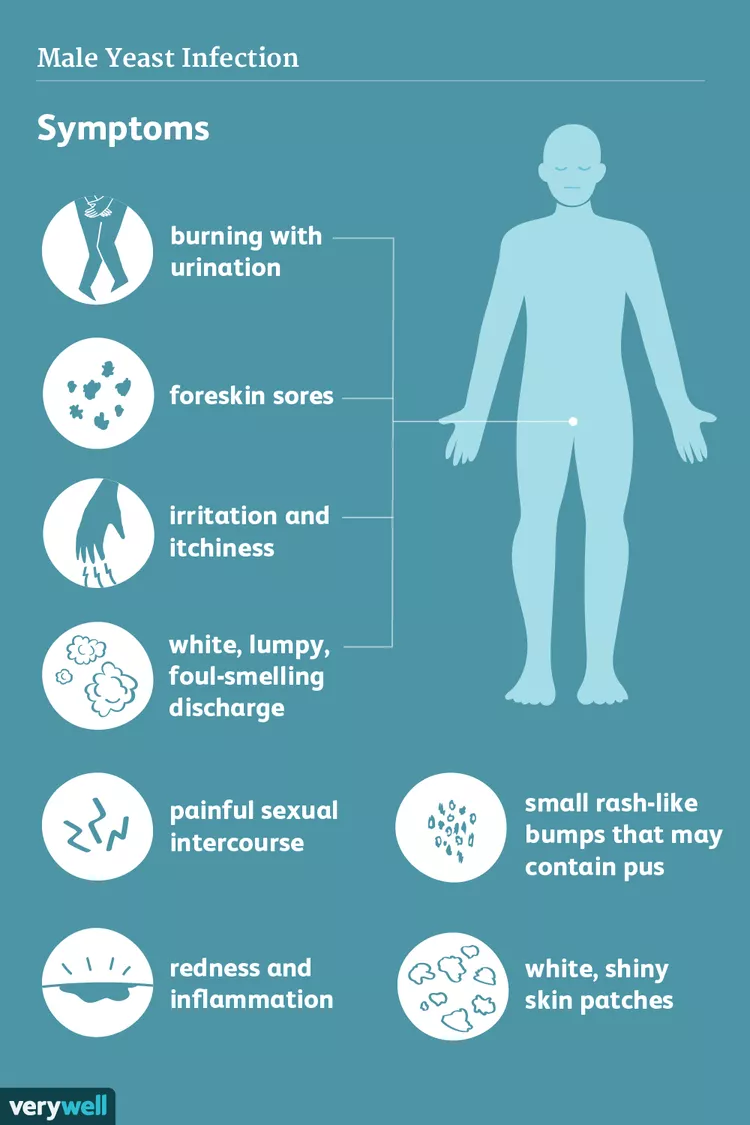 yeast infection penile rash malaysia