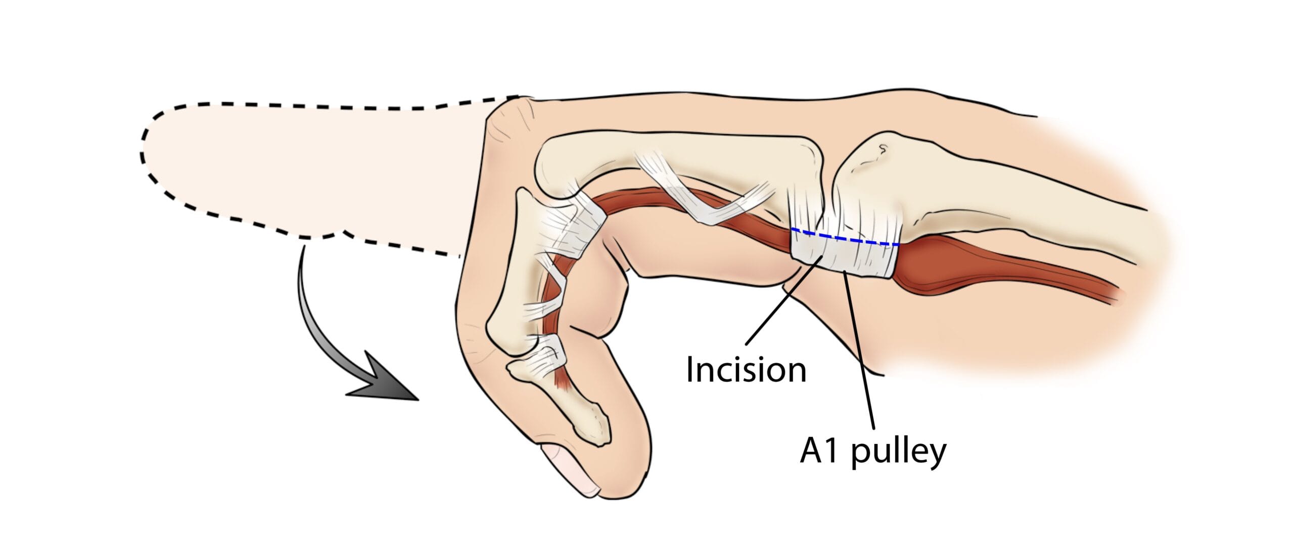 a diagram of a human foot