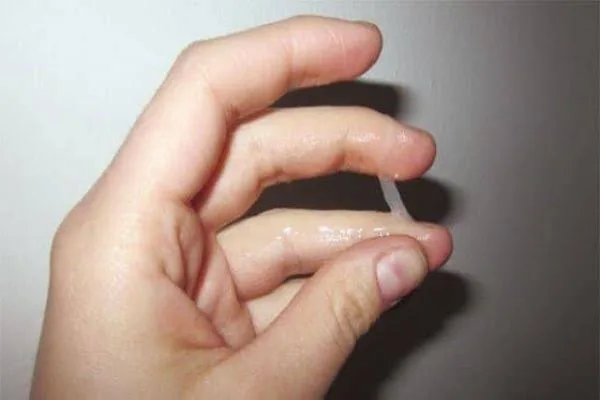 Close up of an individual having white mucus between fingers
